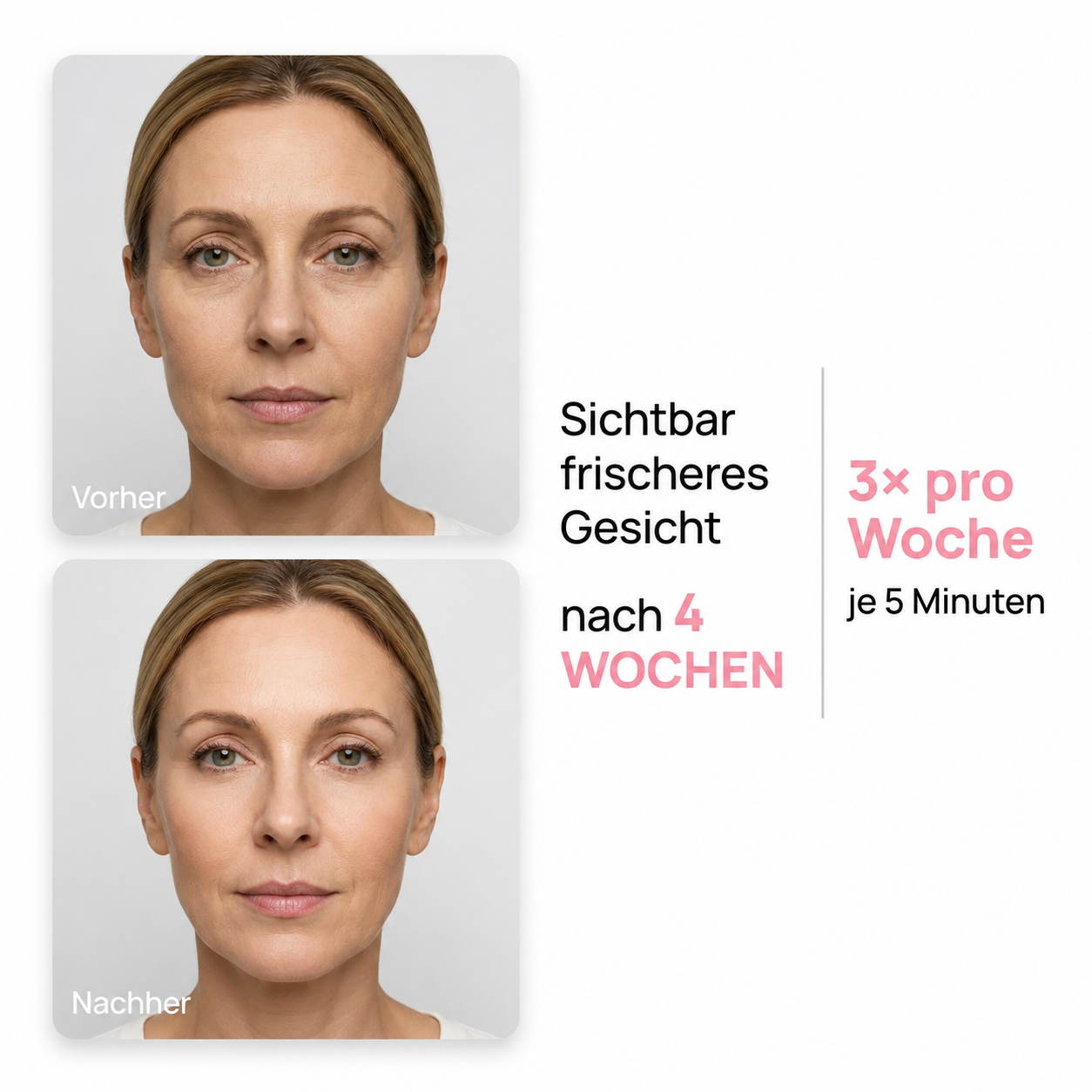 Syporia Face Lift- in 60 Tagen zu einem strafferen Gesicht
