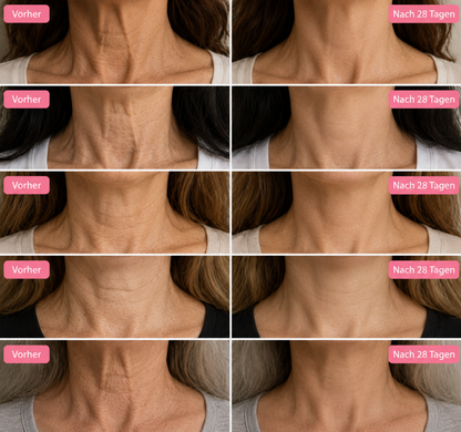 Syporia Face Lift- in 60 Tagen zu einem strafferen Gesicht