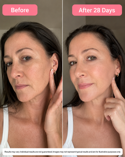 Syporia Eye Lift - sichtbar glattere Augenpartie in 60 Tagen