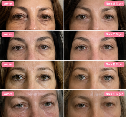 Syporia Eye Lift - sichtbar glattere Augenpartie in 60 Tagen